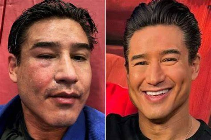 After Being Hospitalized, Mario Lopez’s Death Becomes Widely Known Online. Is He Alive Or Dead?