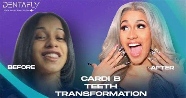 Cardi B's Teeth Transformation A Complete Breakdown