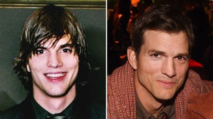 Did Ashton Kutcher Get Plastic Surgery? The Truth Behind His Nose and Hair