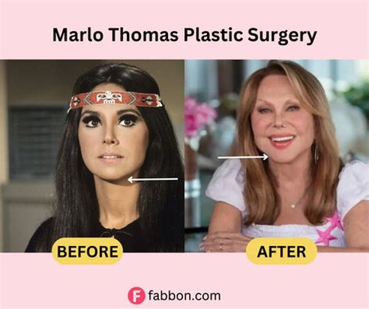 Did Marlo Thomas Undergo Face Surgery? Before And After Photos On IG ·