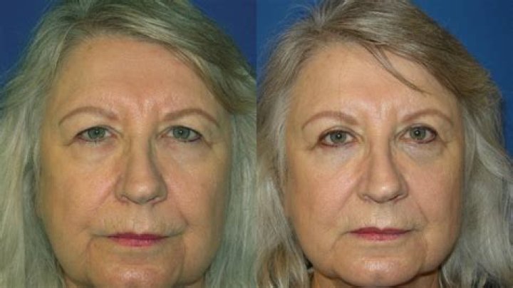 Discoveries And Insights Before Surgery