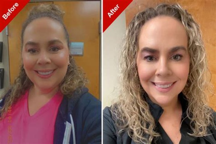 Has Carli Bybel Had A Plastic Surgery? Before And After Photos On IG ·