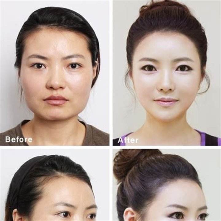 Has Uhm Jung Hwa Done Plastic Surgery? Before & After Photos ·