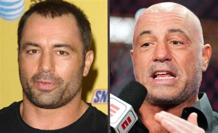 How Did Joe Rogan Get That Head Scar? Here's the Surprising Story