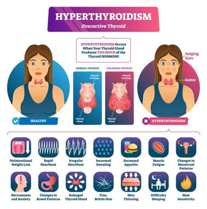 Jet Li Illness Hyperthyroidism Condition 2023: Health