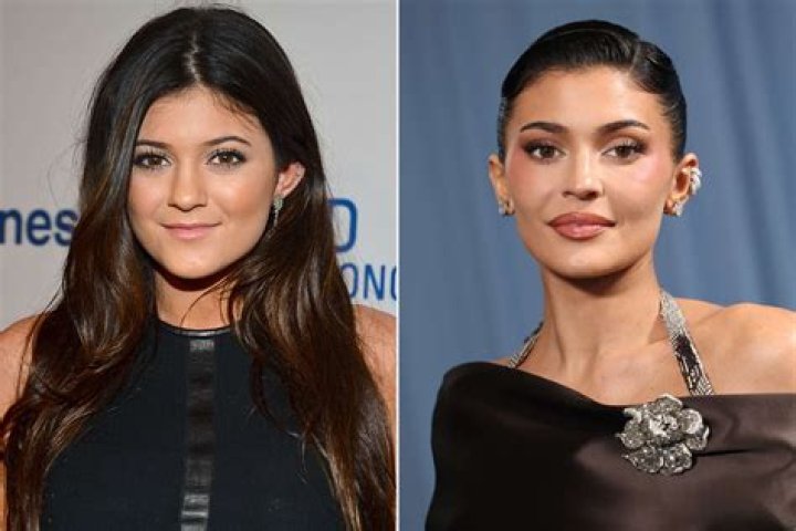 KYLIE JENNER PLASTIC SURGERY RUMORS ADDRESSED-Video