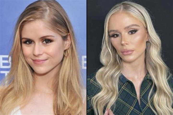 Lisa Helou Before Plastic Surgery Unveiled
