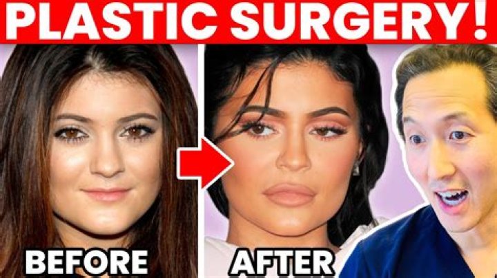 Mimi Keene's Plastic Surgery Journey Explored