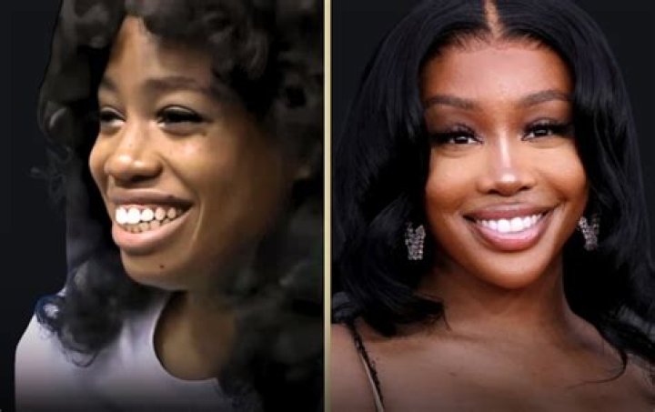 SZA Before Surgery: How the Singer Transformed Her Looks and Voice