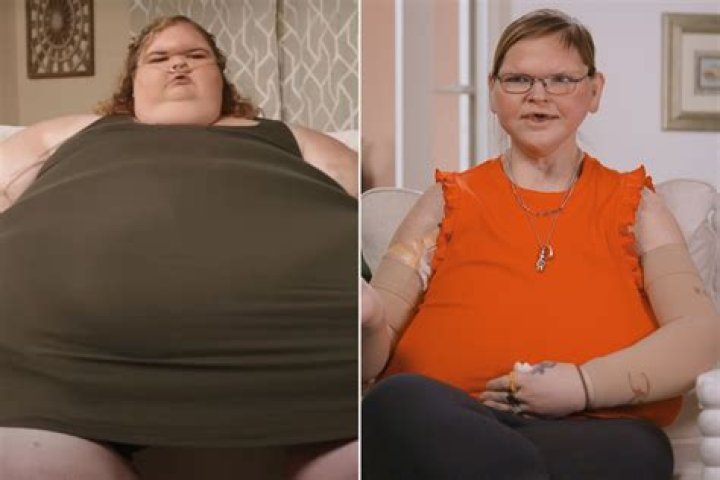 The Truth About Chris Combs' Weight Loss Surgery on '1000-Lb Sisters'