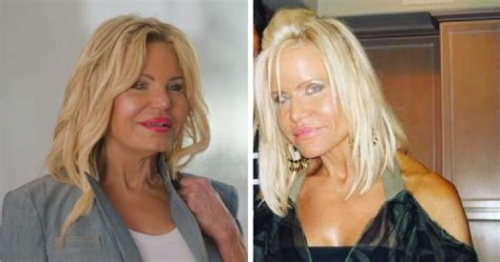 Unveiling The Art Of "Gio Helou Mom Plastic Surgery"
