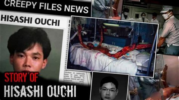 Unveiling The Devastating Truths Behind "Hisashi Ouchi Pictures In Hospital"
