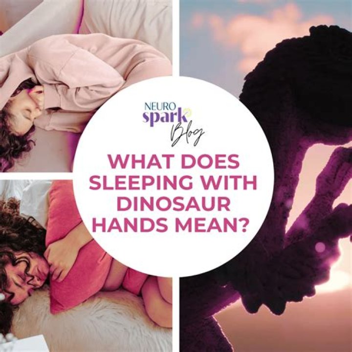 Unveiling The Secrets Of "Sleeping With Dinosaur Hands" ADHD