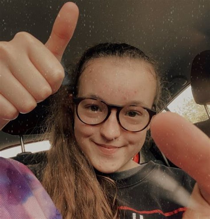 What Happened To Bella Ramsey Teeth? Health Update Parents And Instagram