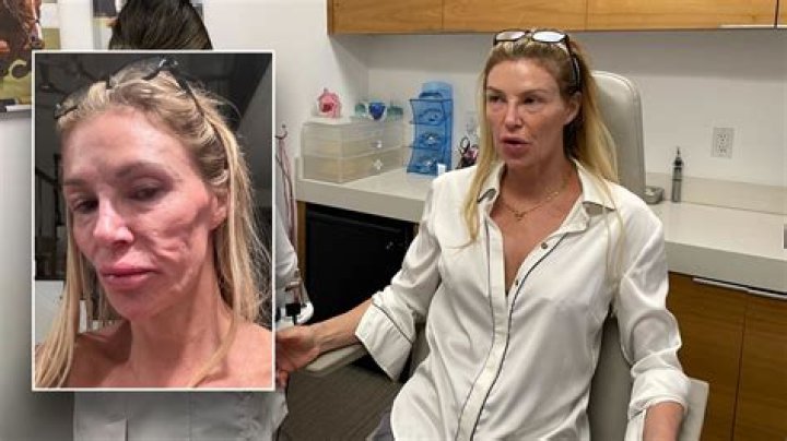 What Happened To Brandi Glanville's Face? Has She Done Plastic Surgery