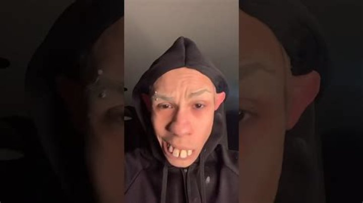 What Is Wrong With His Teeth?