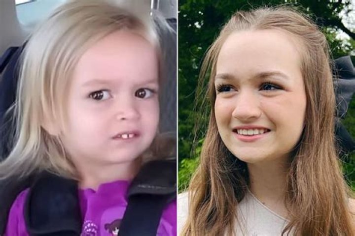 Why was Chloe Lukasiak bullied? Chloes brave face against her trollers, her sinister eye conditio
